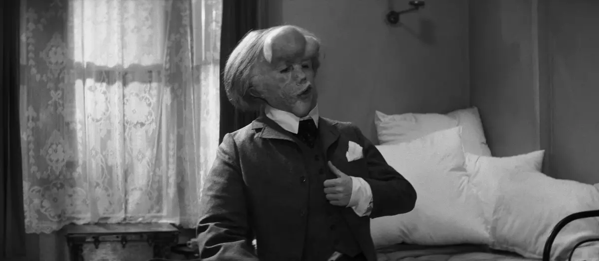 John Hurt in The Elephant man (1980), @Webphoto